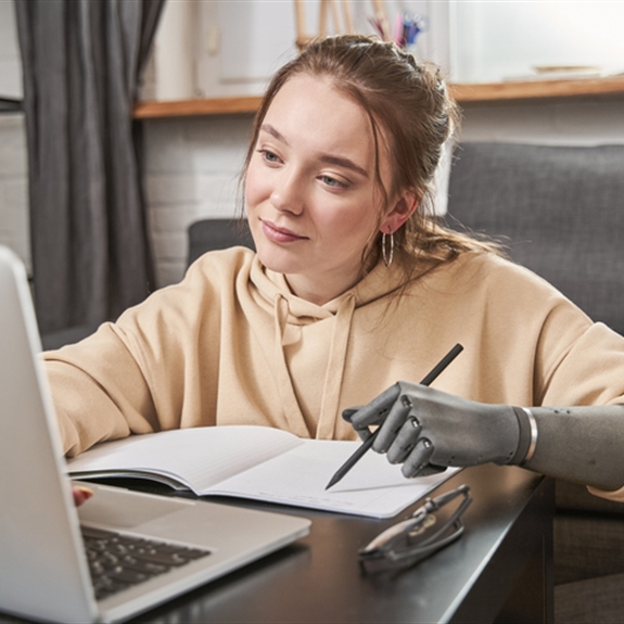 Woman with prosthesis arm writing at notebook